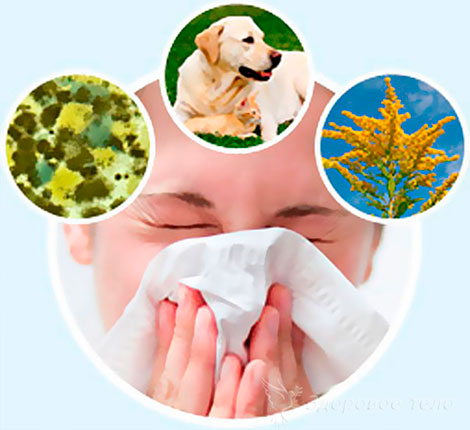 Аллергия: причины и симптомы